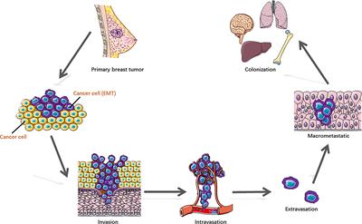 E3 Ubiquitin Ligases in Breast Cancer Metastasis: A Systematic Review of Pathogenic Functions and Clinical Implications